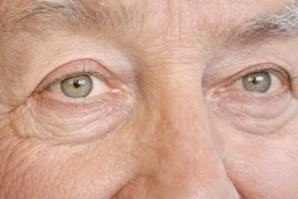 Older adult with bright eyes and gentle smile