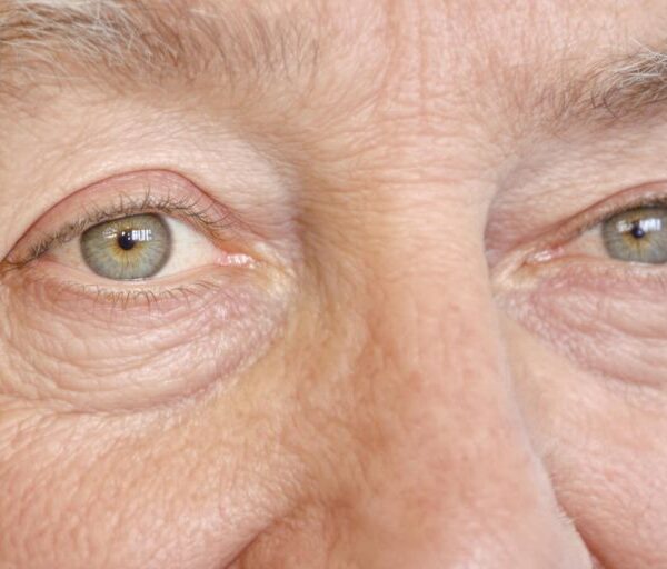 Am I Too Old For Lasik?