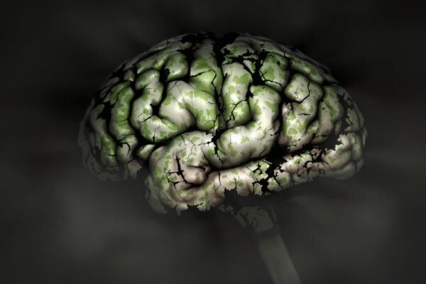 What is Brain Rot? Decaying human brain with dark, cracked areas visible.